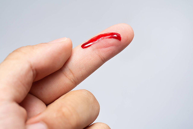 出血した人差し指